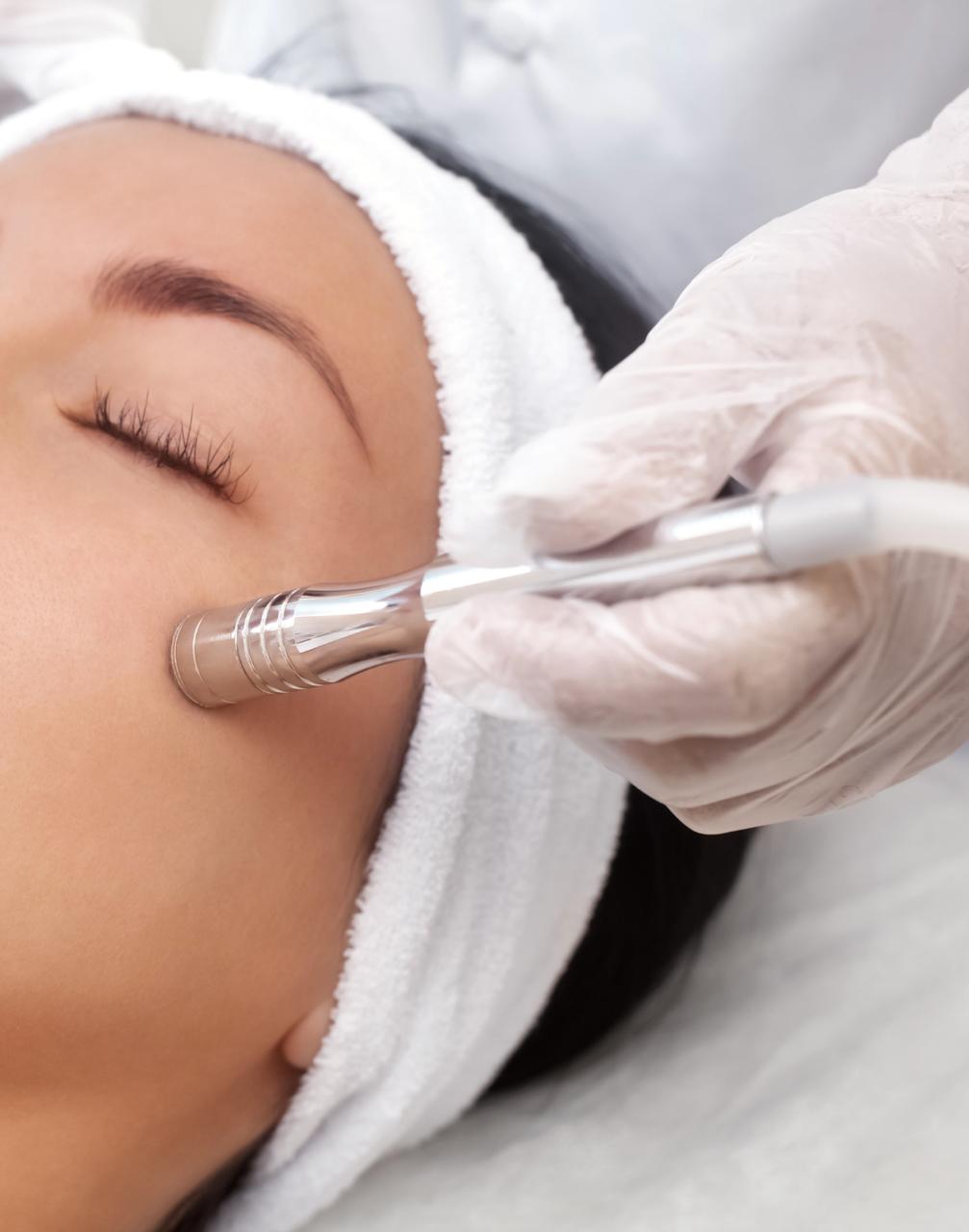 Microdermabrasion